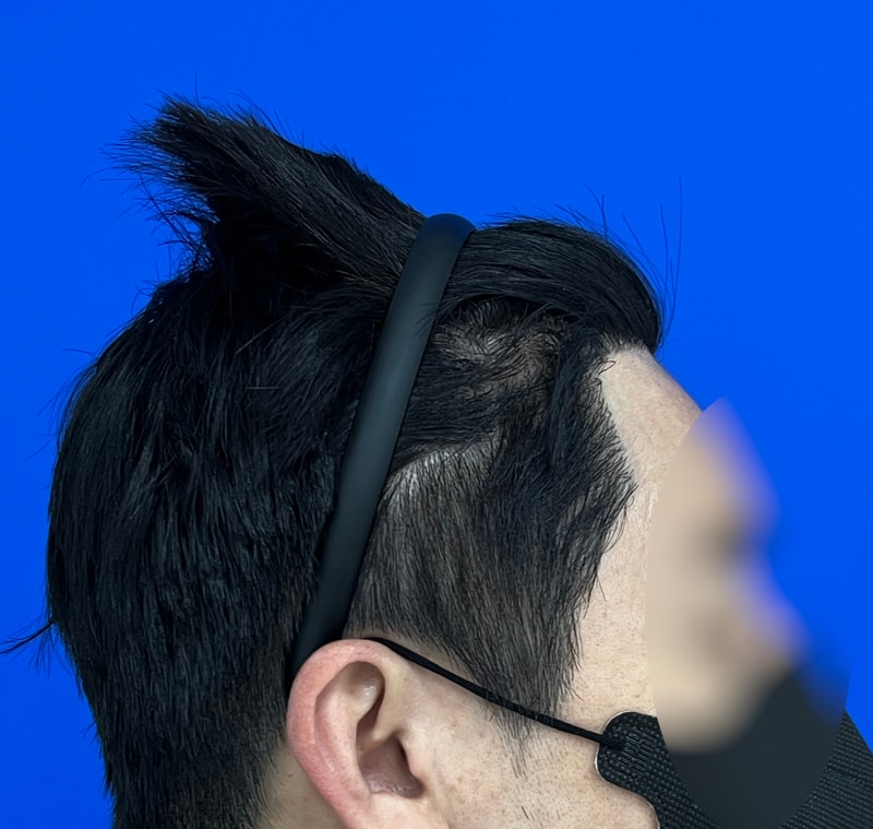 수술후 1.jpg