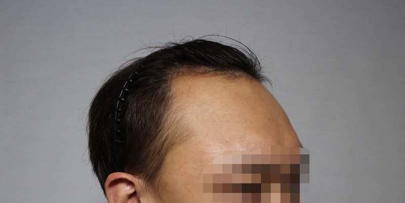 전 2.jpg