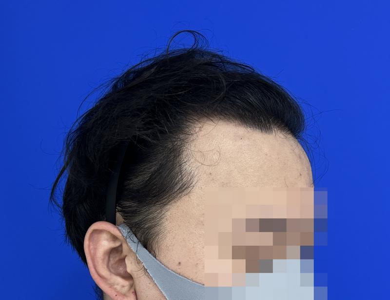 수술전 1.jpg