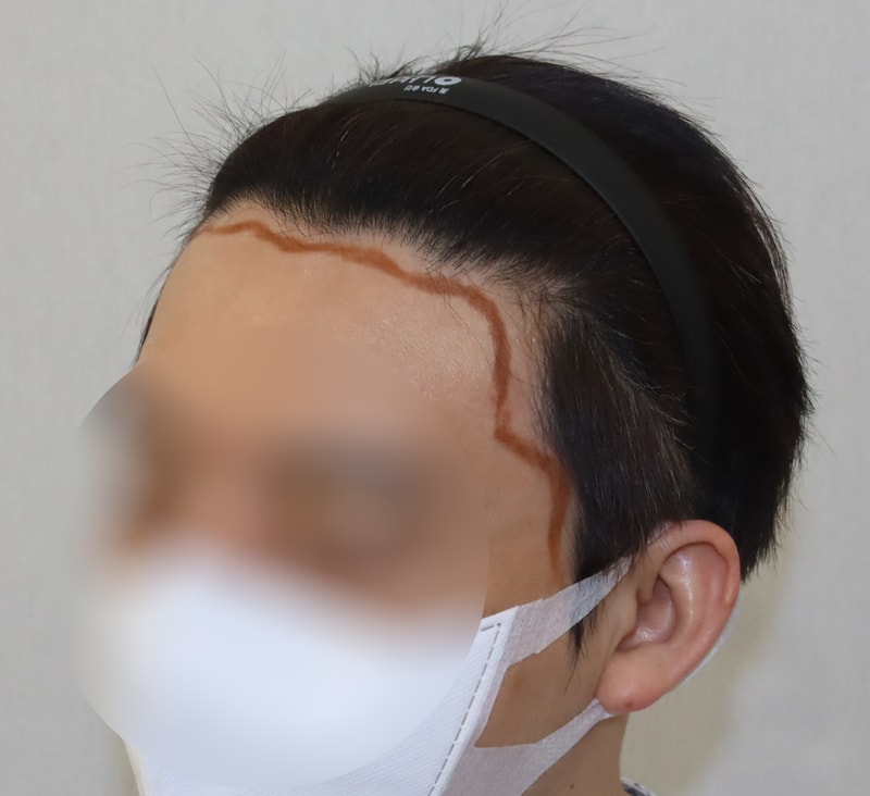 수술전 2.jpg