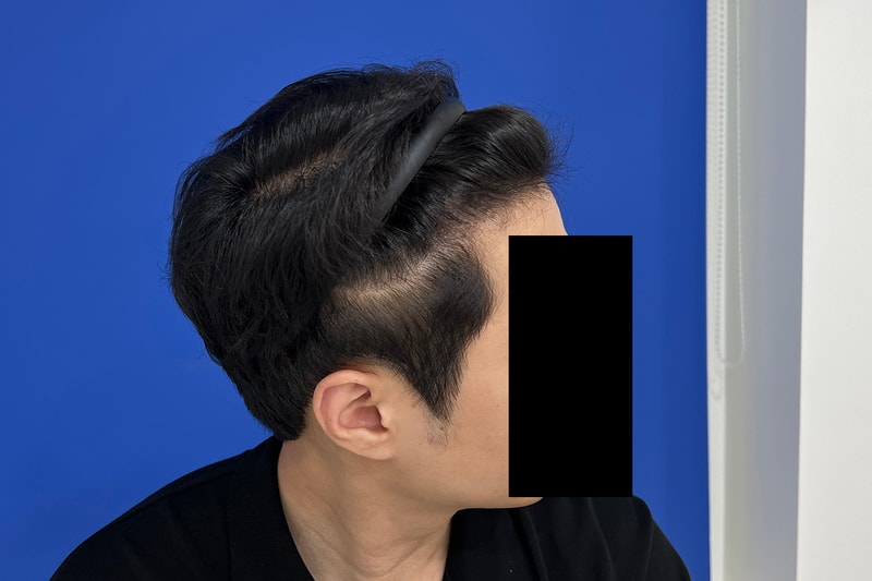 수술후 3 복사.jpg