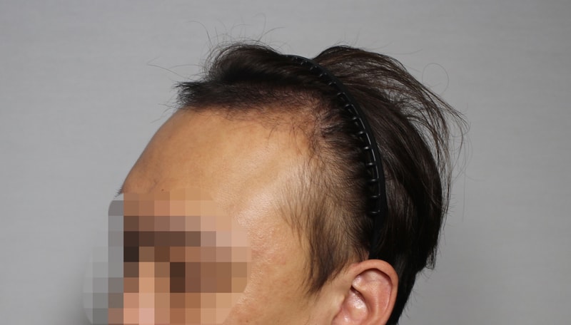 후 2.jpg