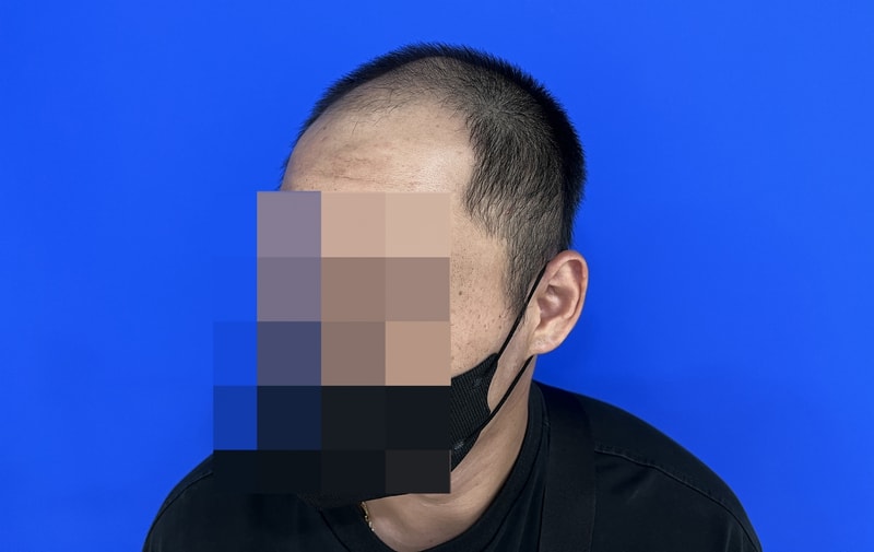 수술전 2 복사.jpg