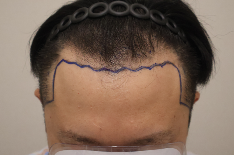 포토후기 이미지