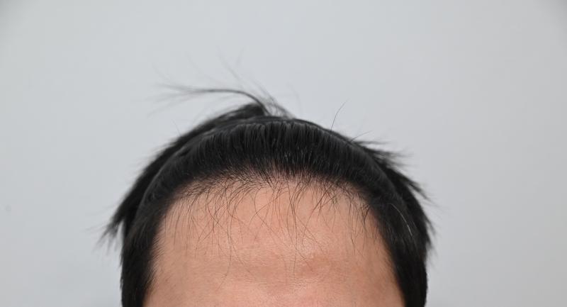 3200모이식