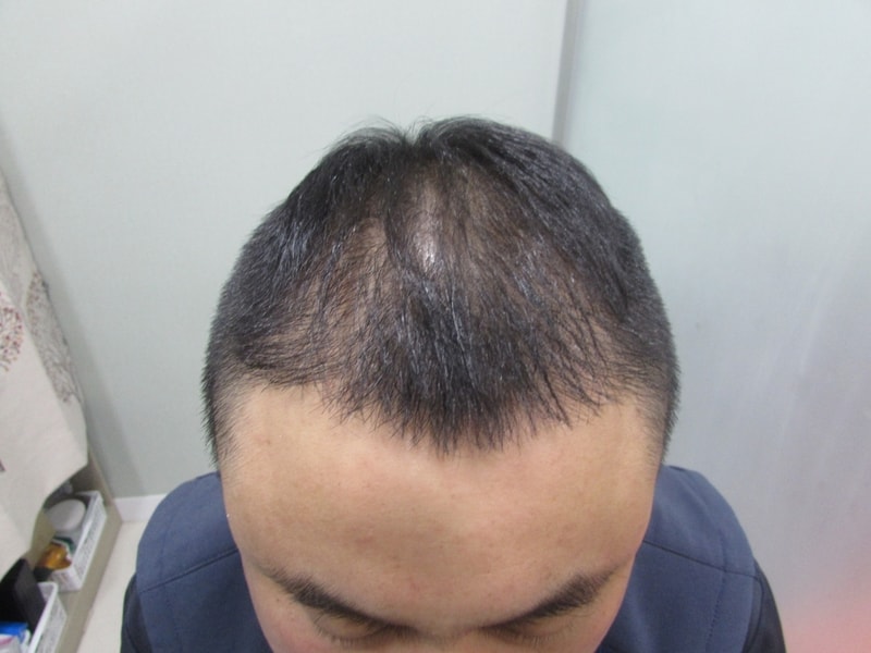 KakaoTalk_20180713_152021188.jpg