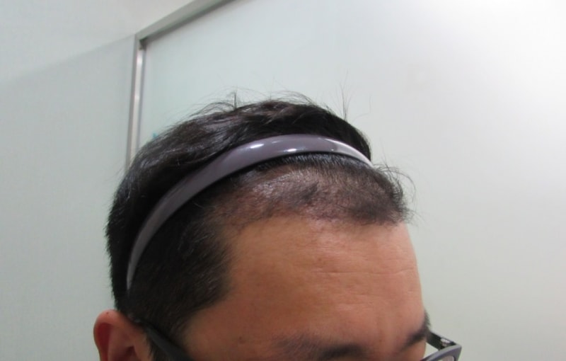 수술후.jpg