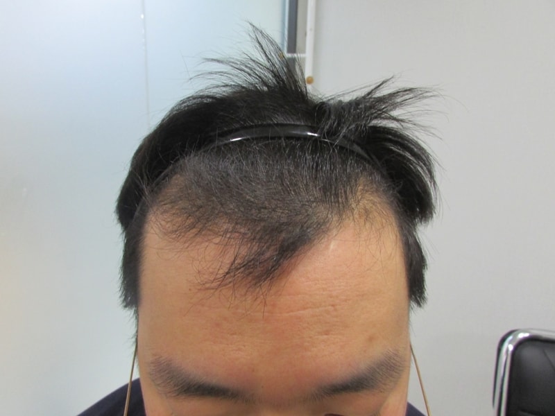 수술전.jpg