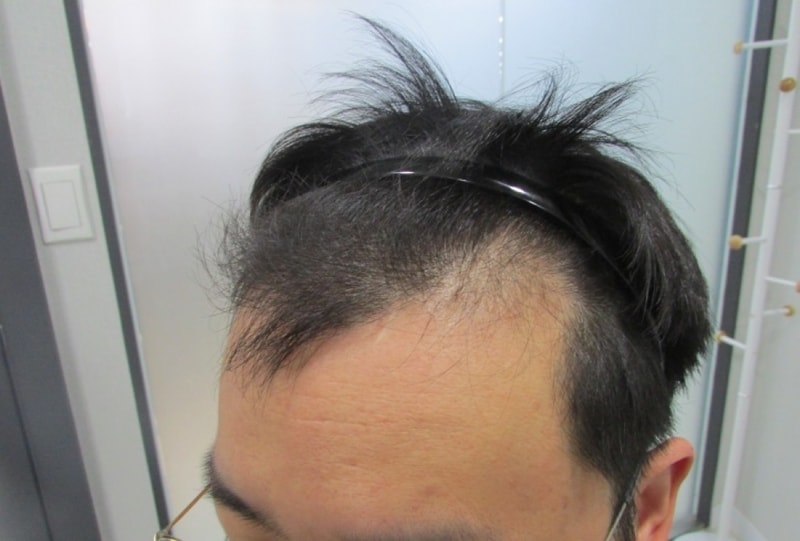 수술전1.jpg