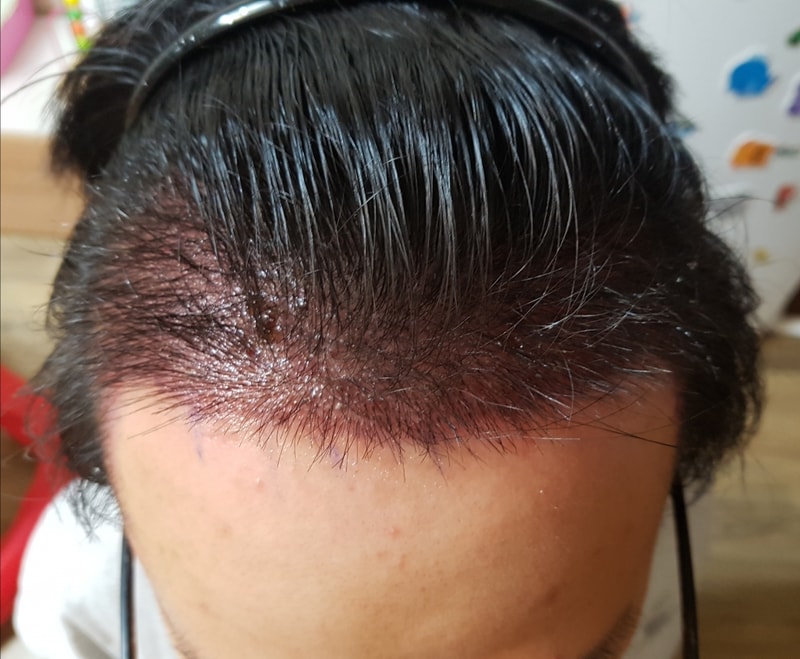 20180518_203613.jpg
