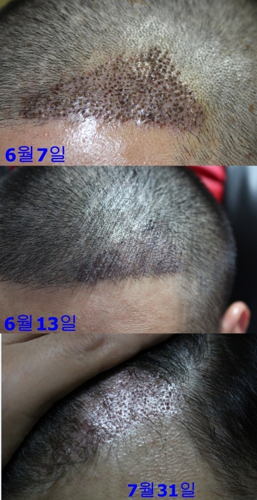 뉴헤어 2개월차 후기입니다.