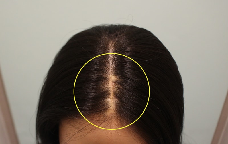 포토후기 이미지