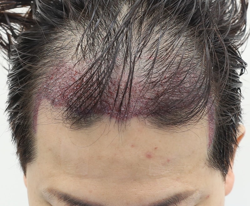 2주된 1461모 후기