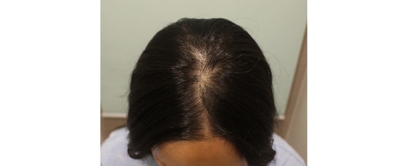 포토후기 이미지