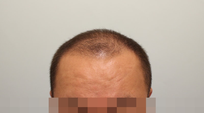 포토후기 이미지