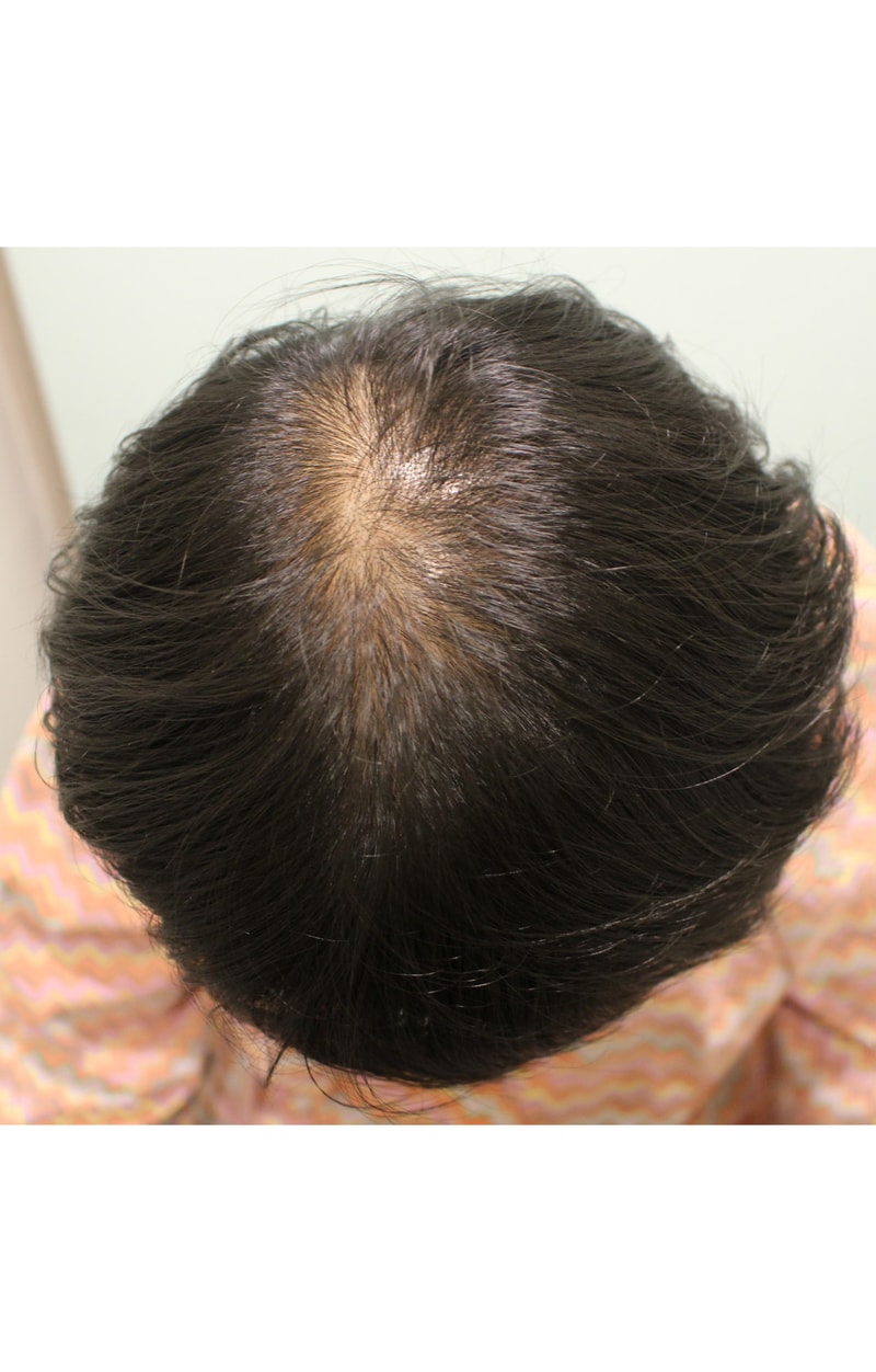 포토후기 이미지