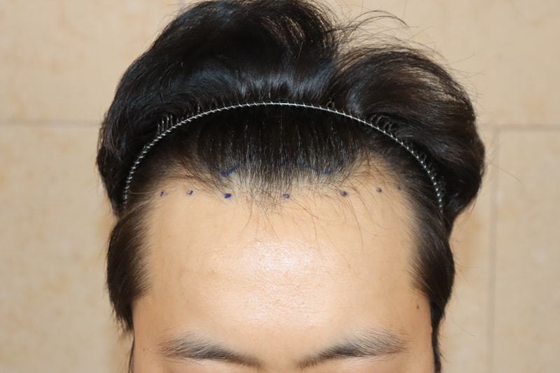 포토후기 이미지