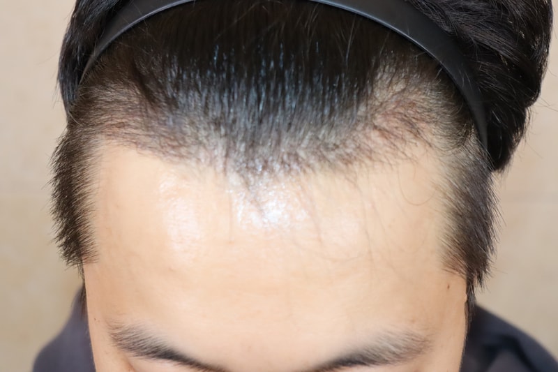 포토후기 이미지