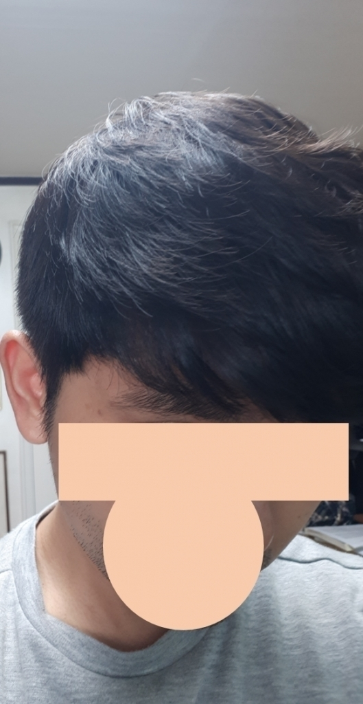내린머리2.png