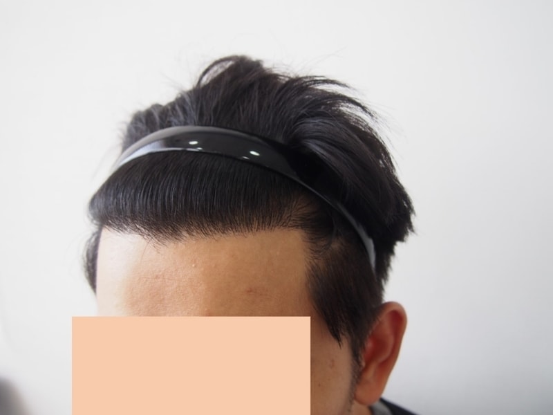 왼쪽1.jpg