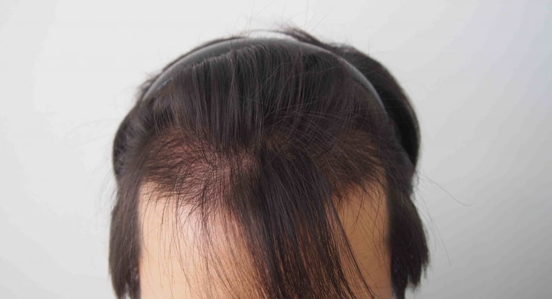 정면(5개월-1).jpg