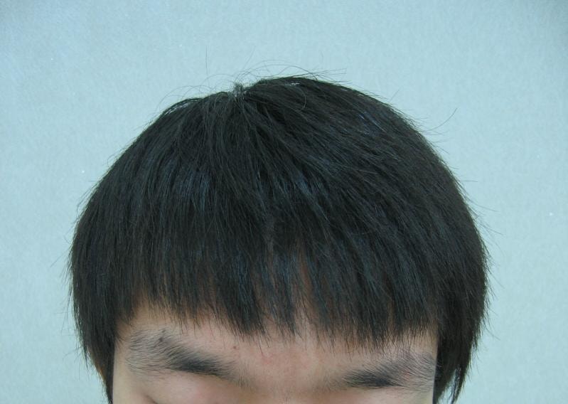 이식전내루고.jpg