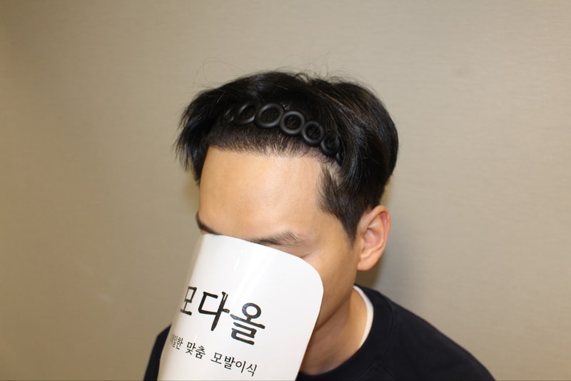 6개월 왼.jpg
