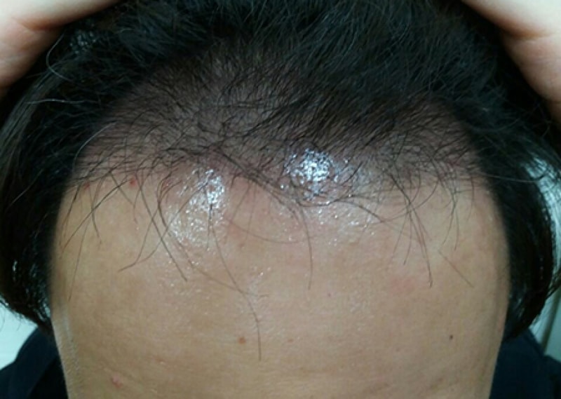 수술후.jpg