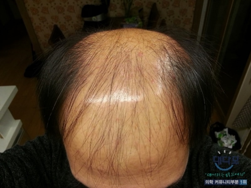 지난번올린사진.jpg