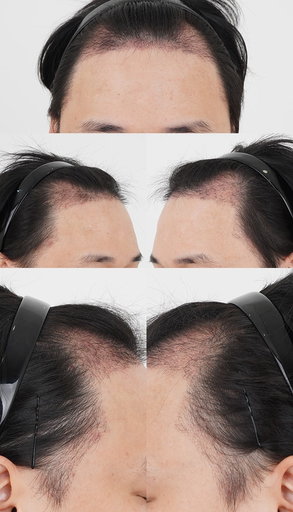 10 암흑기.jpg
