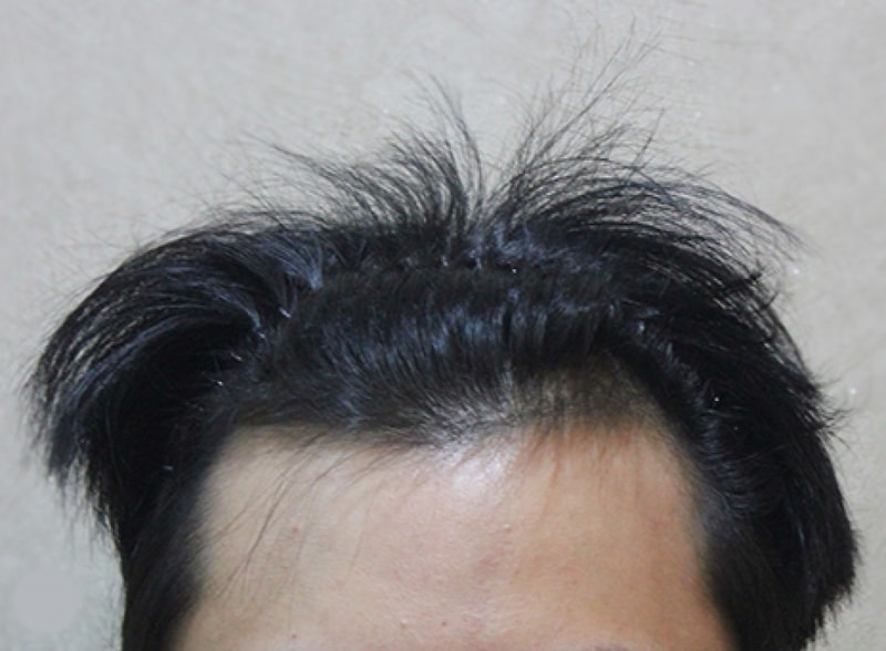 수술전_1.jpg