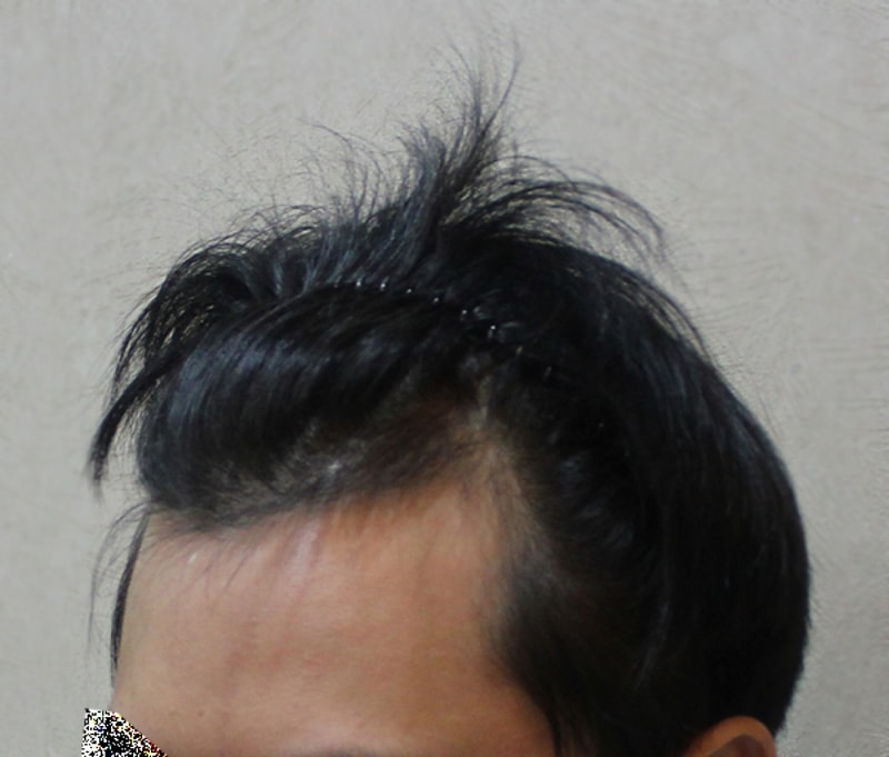 수술전_3.jpg