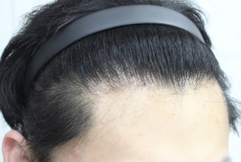 수술후_01.jpg