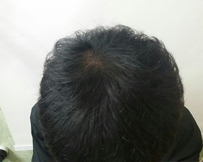 7개월차.jpg