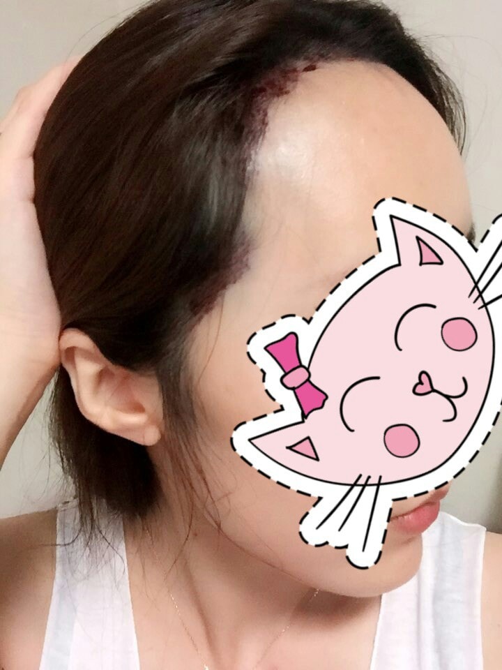KakaoTalk_20170920_172616432.jpg