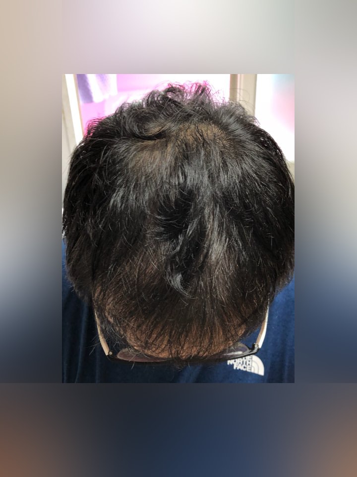 KakaoTalk_20180728_082746477.jpg