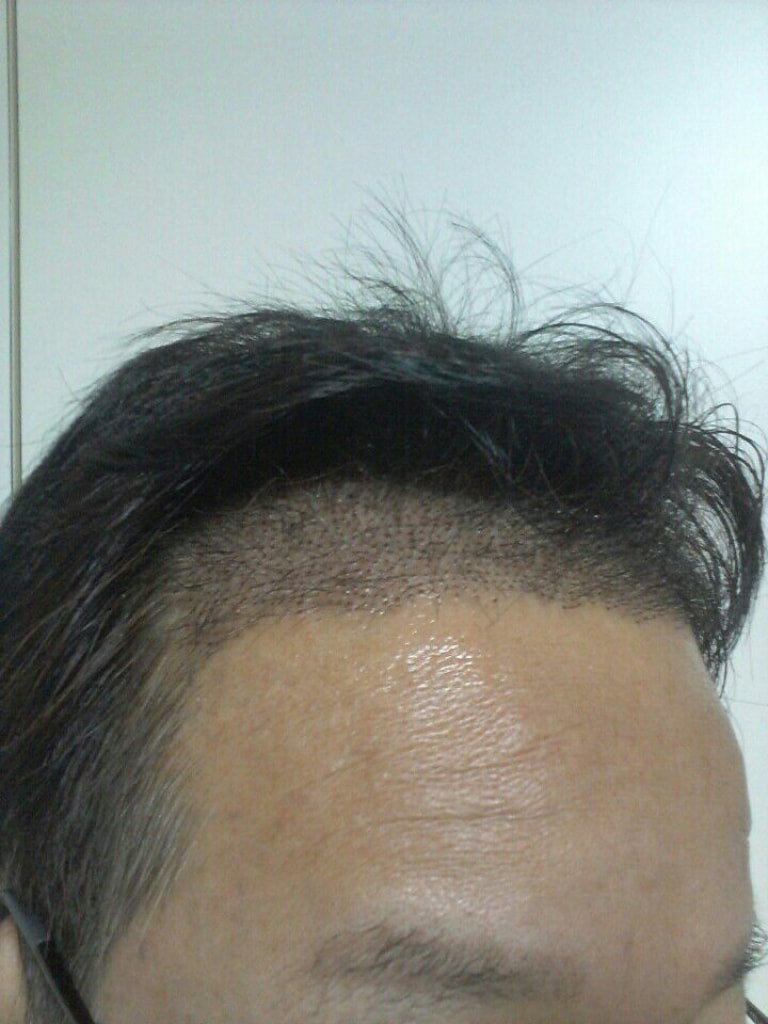 수술후3.jpg