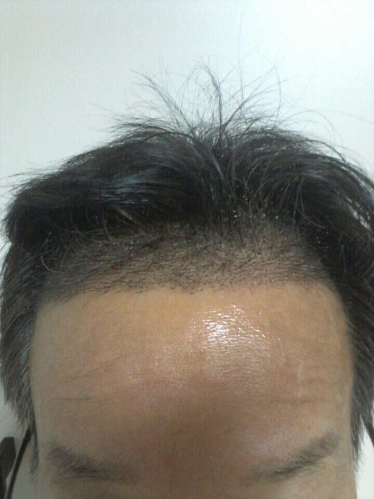 수술후2.jpg