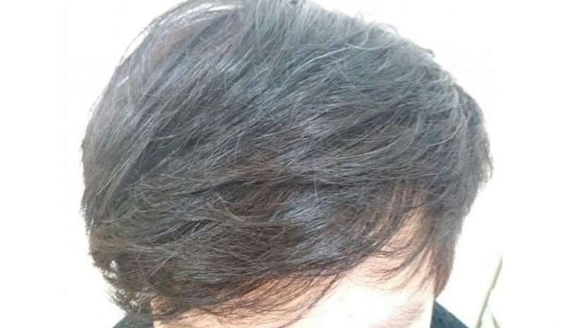후2.jpg