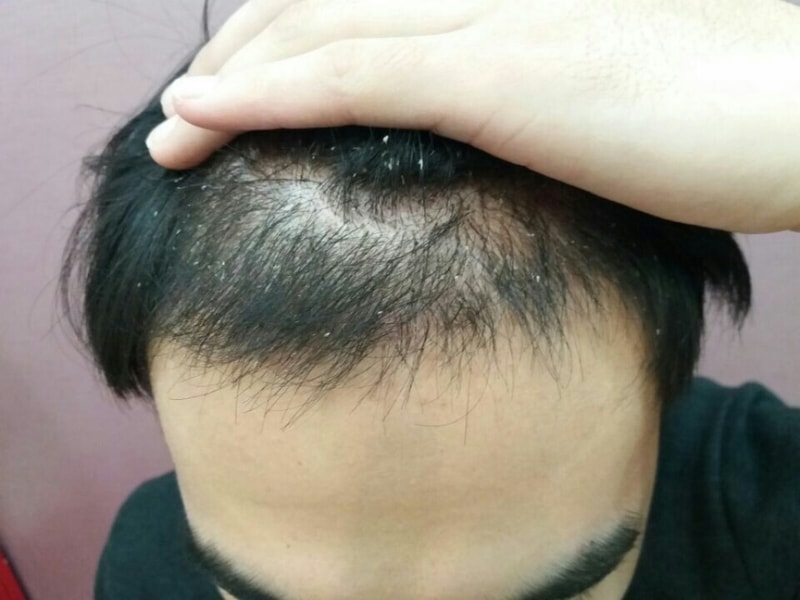 후4.jpg