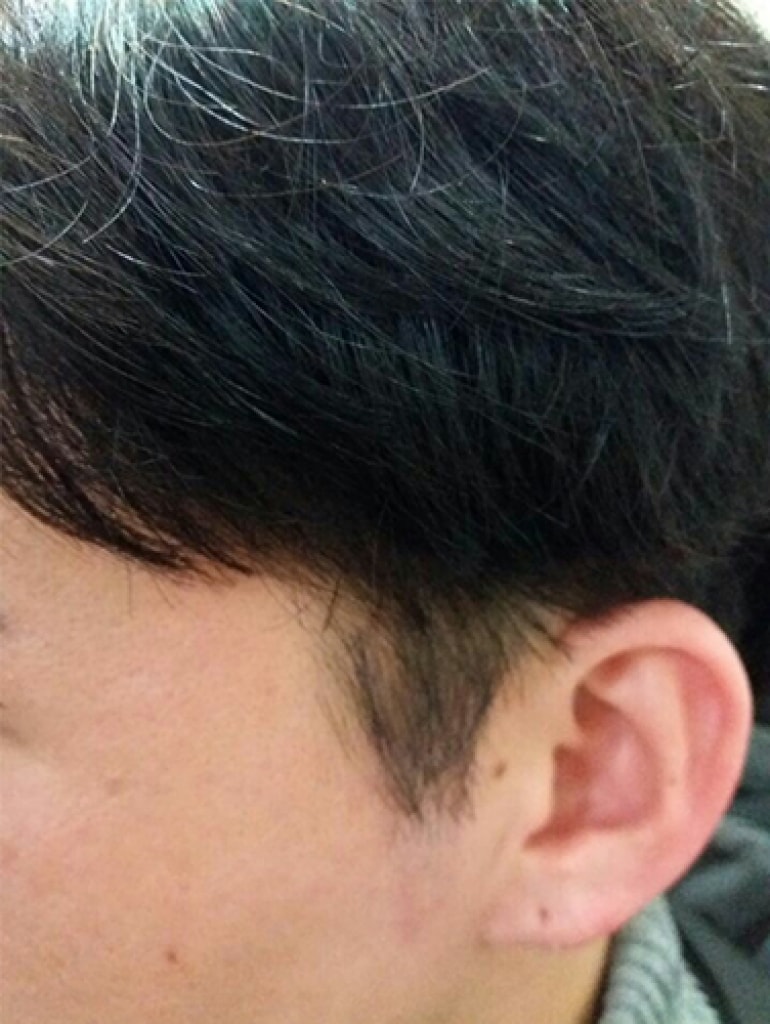 후구렛나루2.jpg