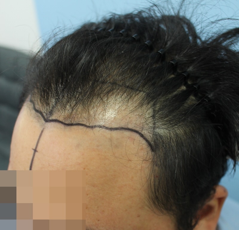 M자 9.JPG