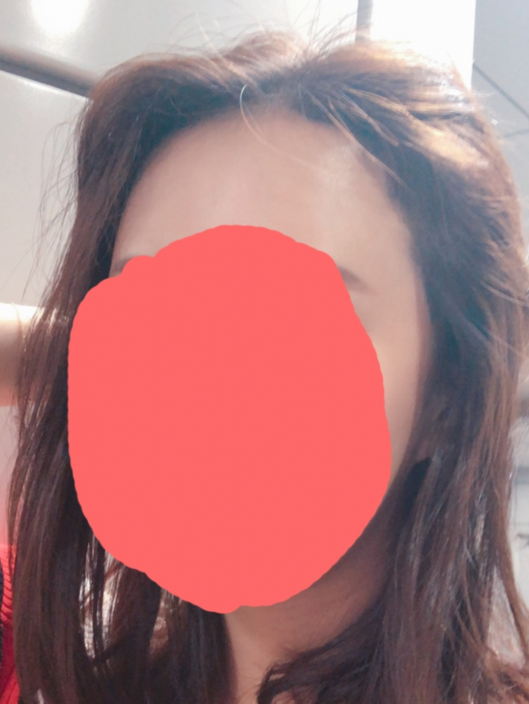 수술2일_2.png
