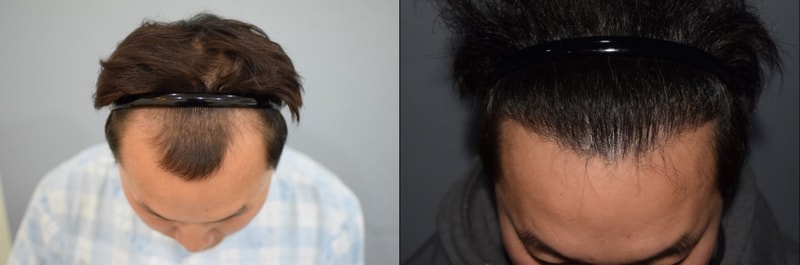 아래.JPG