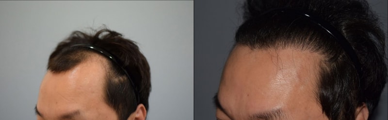 왼.JPG