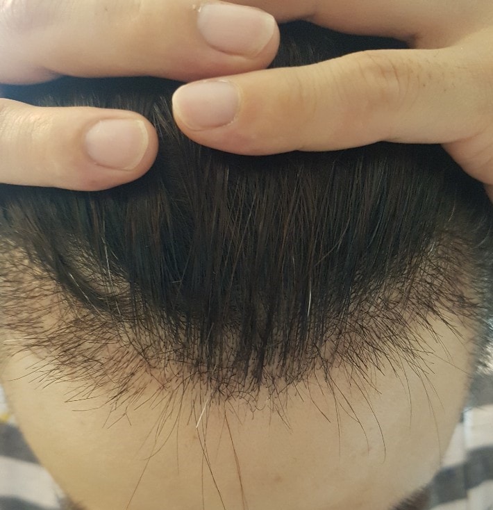 ㄷㄴ1 It's been a month since I had my hair shaved