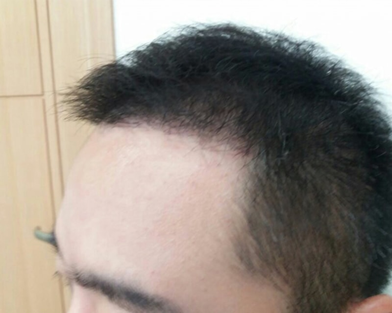 후2.jpg