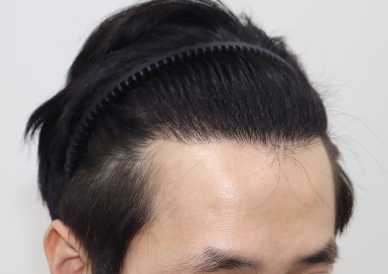 1 1.JPG