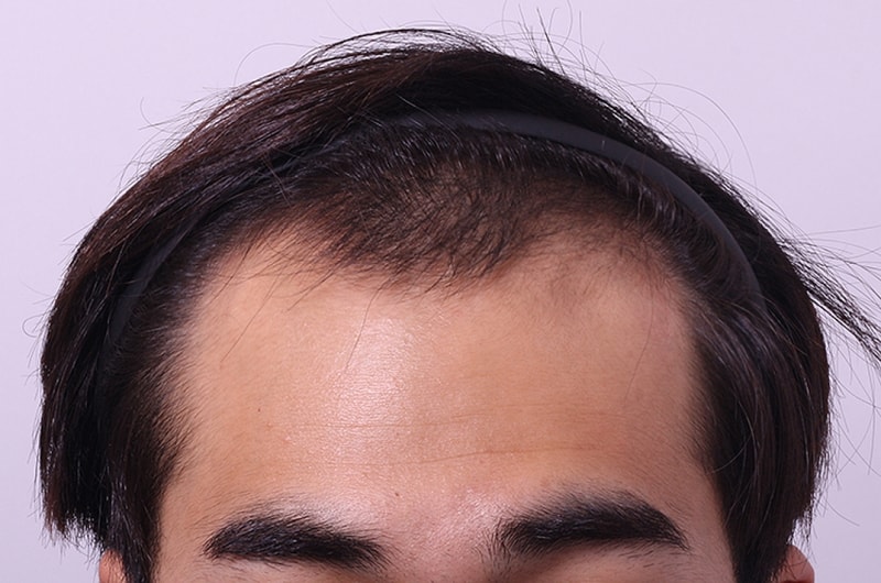 수술전1.jpg