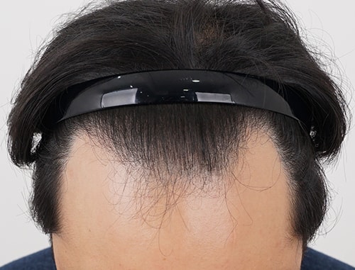 How is the non-cut 4000 Mo 10 months review??
